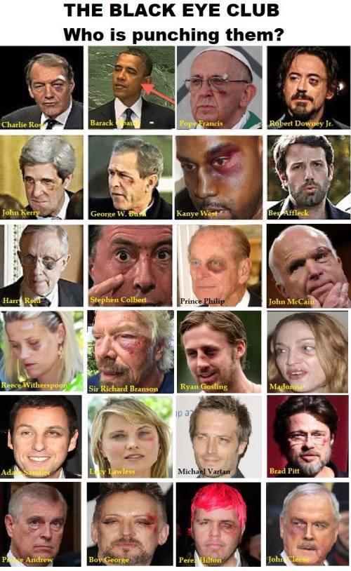 Black Eye Club List of Celebrities